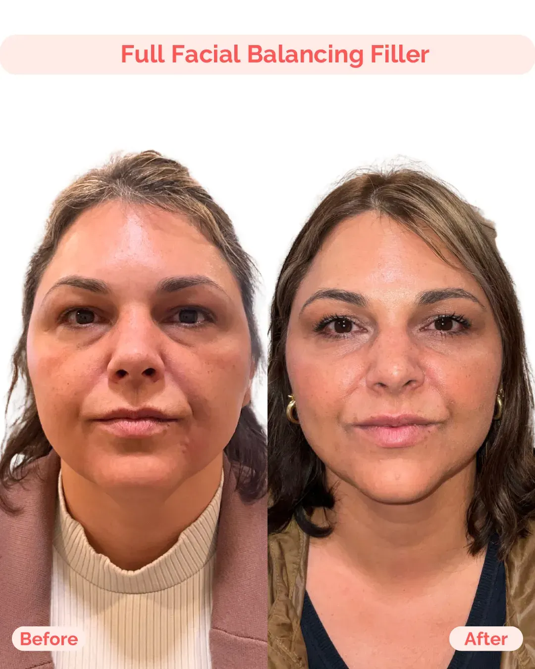 Julia B&A 2025 - 43_min
