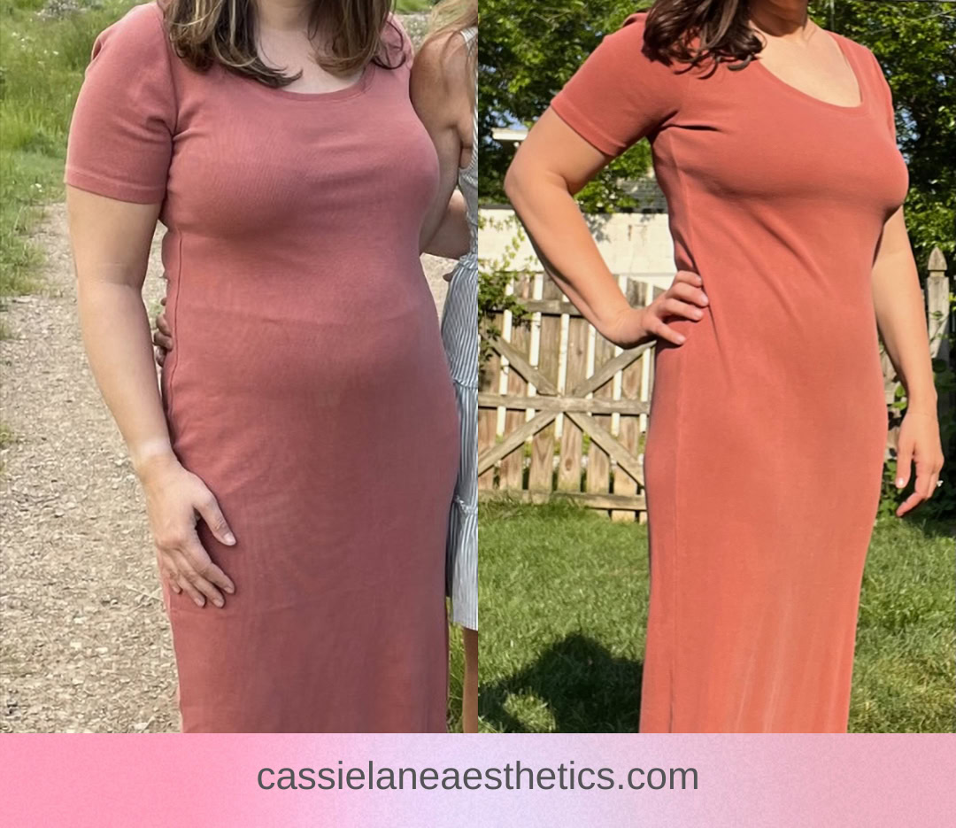 Medical Weight Loss Richmond VA